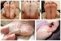 Лот: 3784579. Фото: 2. Педикюрная маска. Обновление кожи... Медицина