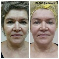 Лот: 11928001. Фото: 2. Скульптурный массаж лица "Creando... Косметика и уход
