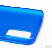 Лот: 18098349. Фото: 2. Чехол Samsung A51/A31/M40S (2020... Аксессуары