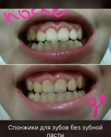 Лот: 11687994. Фото: 2. Спонжи Aquamagic LASKA для чистки... Косметика и уход