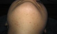 Лот: 2409894. Фото: 17. Электроэпиляция - это твой выбор...