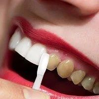 Лот: 4606632. Фото: 6. стоматологическая зубная минерализующая...