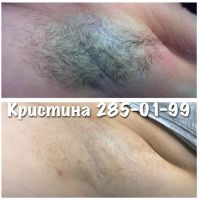 Лот: 2316112. Фото: 5. Электроэпиляция. Микропигментирование...