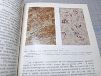Лот: 25069052. Фото: 6. Oz (4092325) Патология реанимации...