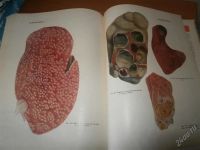 Лот: 2938791. Фото: 3. Атлас патологической анатомии... Литература, книги
