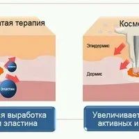 Лот: 8246693. Фото: 6. Дермароллеры 0.5mm, 0.75mm, 1...