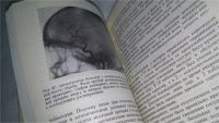 Лот: 10679374. Фото: 3. Клиническая диагностика опухолей... Литература, книги
