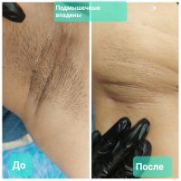 Лот: 20542840. Фото: 3. Восковая Депиляция. Услуги