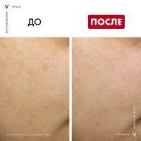 Лот: 23937283. Фото: 6. Виши Лифтактив B3 Ретинол ночной...