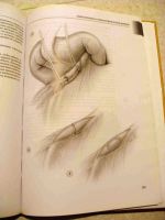 Лот: 16372813. Фото: 3. Атлас сосудистой хирургии. Литература, книги