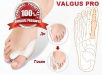Лот: 14288670. Фото: 2. Valgus pro Вальгус Про косточка... Медицина