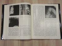 Лот: 21971335. Фото: 4. книга хирургия легких и плевры... Красноярск