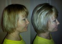 Лот: 4676693. Фото: 6. Средство для проведения процедуры...