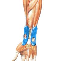 Лот: 10958099. Фото: 2. ManuTrain – активный бандаж для... Медицина