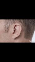 Лот: 15329125. Фото: 6. Пара слуховых аппаратов Oticon...