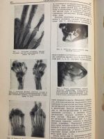 Лот: 9906881. Фото: 3. Большая медицинская энциклопедия... Литература, книги