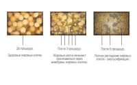 Лот: 6277533. Фото: 6. Антицеллюлитный массаж!!АКЦИЯ...