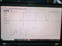 Лот: 25810338. Фото: 8. Ноутбук Lenovo thinkpad w520 Intel...