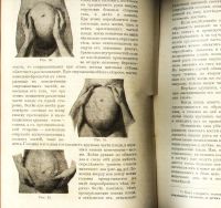 Лот: 20045026. Фото: 14. Н.С. Киселев. Краткий курс акушерства...