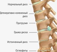 Лот: 16163135. Фото: 7. Тренажер для спины