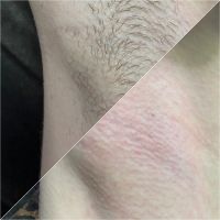 Лот: 24687271. Фото: 2. Депиляция. Красота, здоровье, медицина