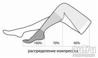 Лот: 9021027. Фото: 2. Чулок компрессионный со швом ЧМК... Медицина