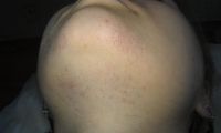 Лот: 2409894. Фото: 16. Электроэпиляция - это твой выбор...