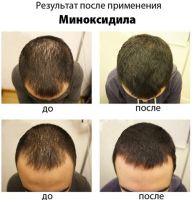 Лот: 11527892. Фото: 2. Лосьон для роста волос и бороды... Косметика и уход