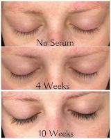 Лот: 11801103. Фото: 6. Advanced Maxlash, сыворотка для...