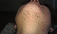 Лот: 2409894. Фото: 7. Электроэпиляция - это твой выбор...