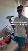 Лот: 18386053. Фото: 4. Лазер по удаления татуировок(прокат... Красноярск