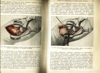 Лот: 19025570. Фото: 3. Оперативная хирургия. Том II... Коллекционирование, моделизм