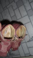 Лот: 9955568. Фото: 3. сандали ортопед. Дети растут