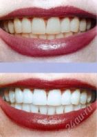 Лот: 1765975. Фото: 2. Отбеливающие полоски Crest 3D... Красота и здоровье