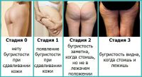 Лот: 6277533. Фото: 11. Антицеллюлитный массаж!!АКЦИЯ...