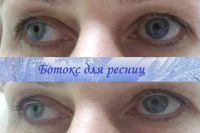 Лот: 6599557. Фото: 5. Биозавивка, ботокс ресниц, шугаринг...