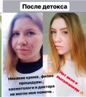 Лот: 11836913. Фото: 2. Детокс-программа очищения организма. Медицина