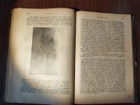 Лот: 24691817. Фото: 6. Учение о болезнях суставов с клинической...