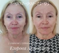Лот: 5981474. Фото: 3. Массаж лица и тела. Красота и здоровье