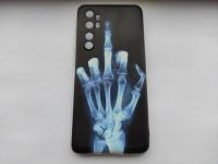 Лот: 16285342. Фото: 2. Чехол-накладка для Xiaomi Mi Note... Аксессуары