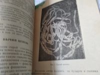 Лот: 17455044. Фото: 6. Бычий цепень - паразит человека...