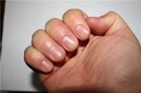 Лот: 3864053. Фото: 7. Красивый маникюр при сложной кутикуле...