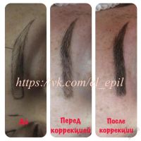 Лот: 2316112. Фото: 18. Электроэпиляция. Микропигментирование...