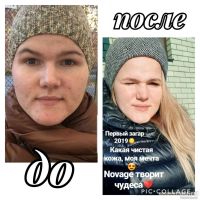 Лот: 13359175. Фото: 2. Комплексный уход за лицом Novage. Косметика и уход
