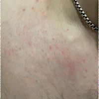 Лот: 24687271. Фото: 3. Депиляция. Услуги