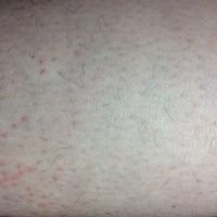 Лот: 2316112. Фото: 3. Электроэпиляция. Микропигментирование... Услуги