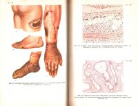 Лот: 7767583. Фото: 3. Патология учебник. — М. Медицина... Литература, книги