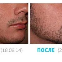 Лот: 5437488. Фото: 3. Сильнейшее средство для роста... Красота и здоровье