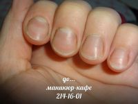 Лот: 3864053. Фото: 3. Красивый маникюр при сложной кутикуле... Услуги