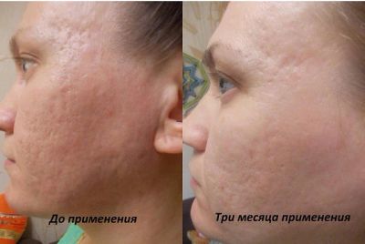 Лот: 6610542. Фото: 1. Клеточная сыворотка Luminesce. Уход за лицом 